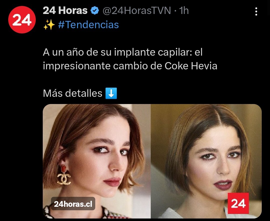 Increíble cambio