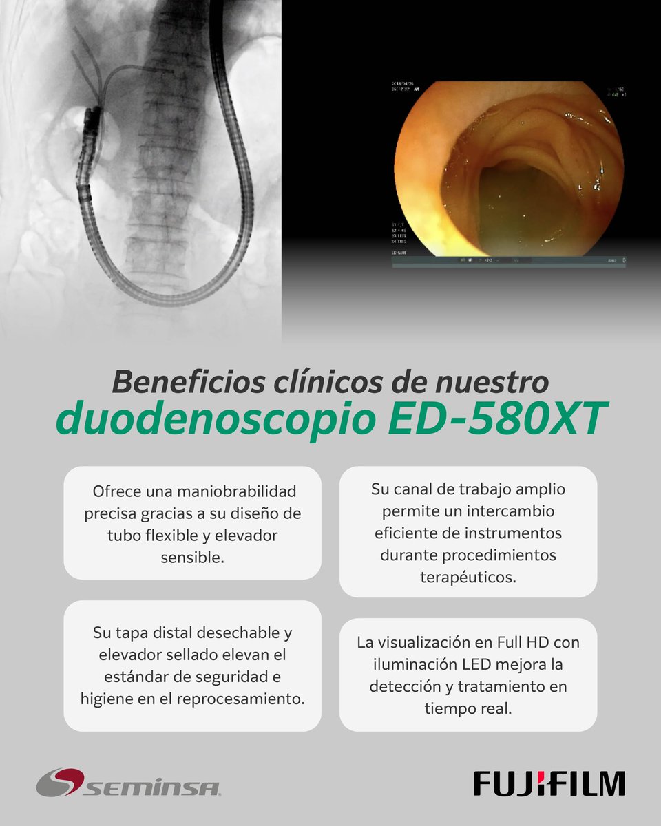 seminsaoficial's tweet photo. Precisión, seguridad e imagen Full HD en cada procedimiento. Descubre los beneficios del duodenoscopio ED-580XT.
#SEMINSA #Fujifilm #CPRE https://t.co/vqPF4bVsQI