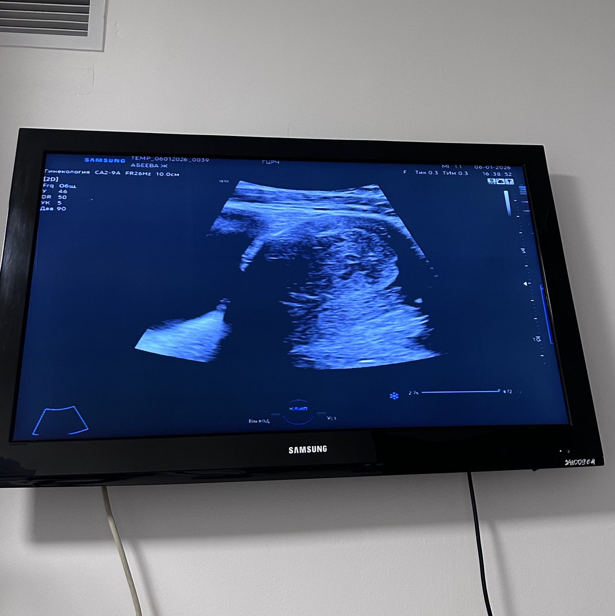 Niya 🥟 tweet media