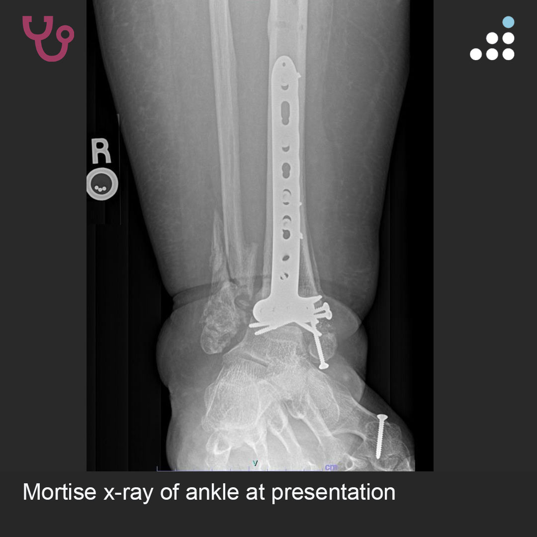 Orthobullets tweet media