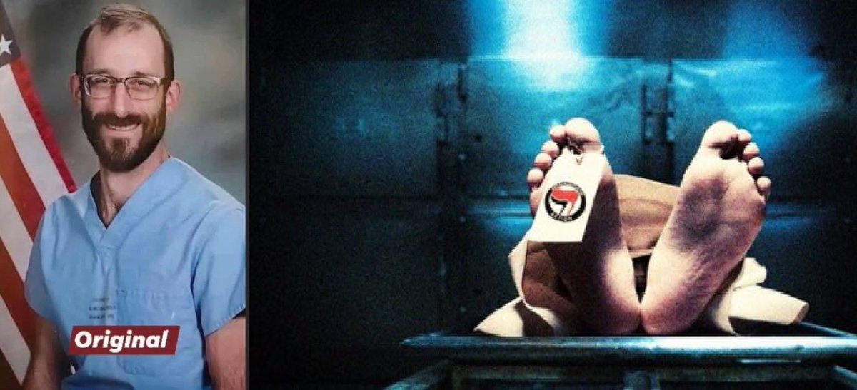 xULTRAMAXIMUSx's tweet image. The Before and After is amazing. 
#Pretti