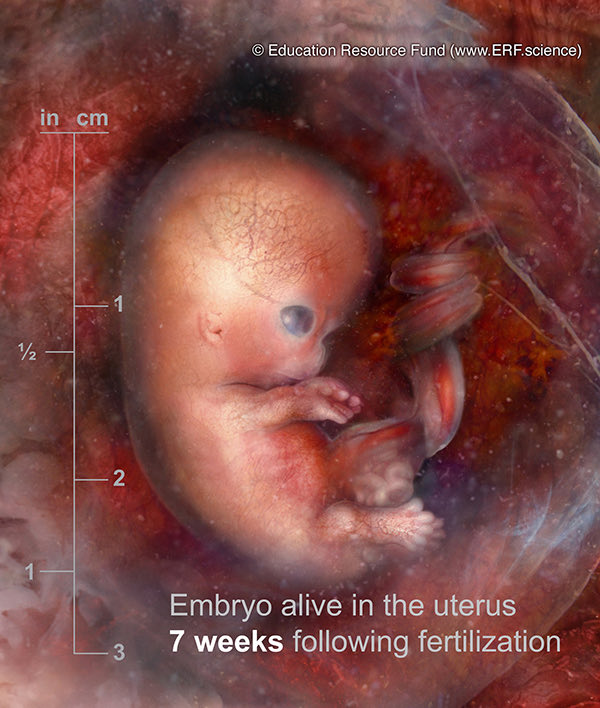 40 Days For Life Pittsburgh tweet media
