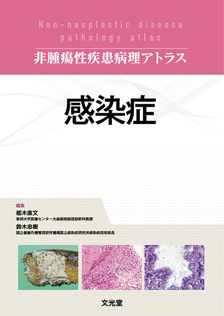 🔊＜非腫瘍性疾患病理アトラス 感染症＞が予約受付中です🤗頻度の高い