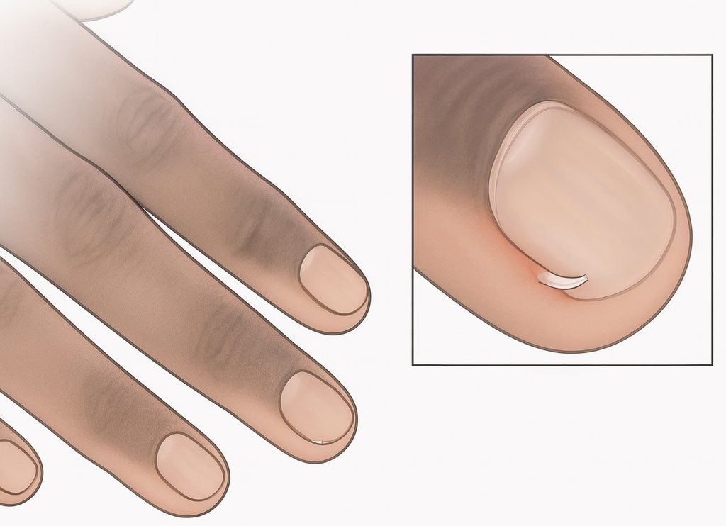 Whotfismick's tweet image. Pulling these hurts more than any breakup 💔