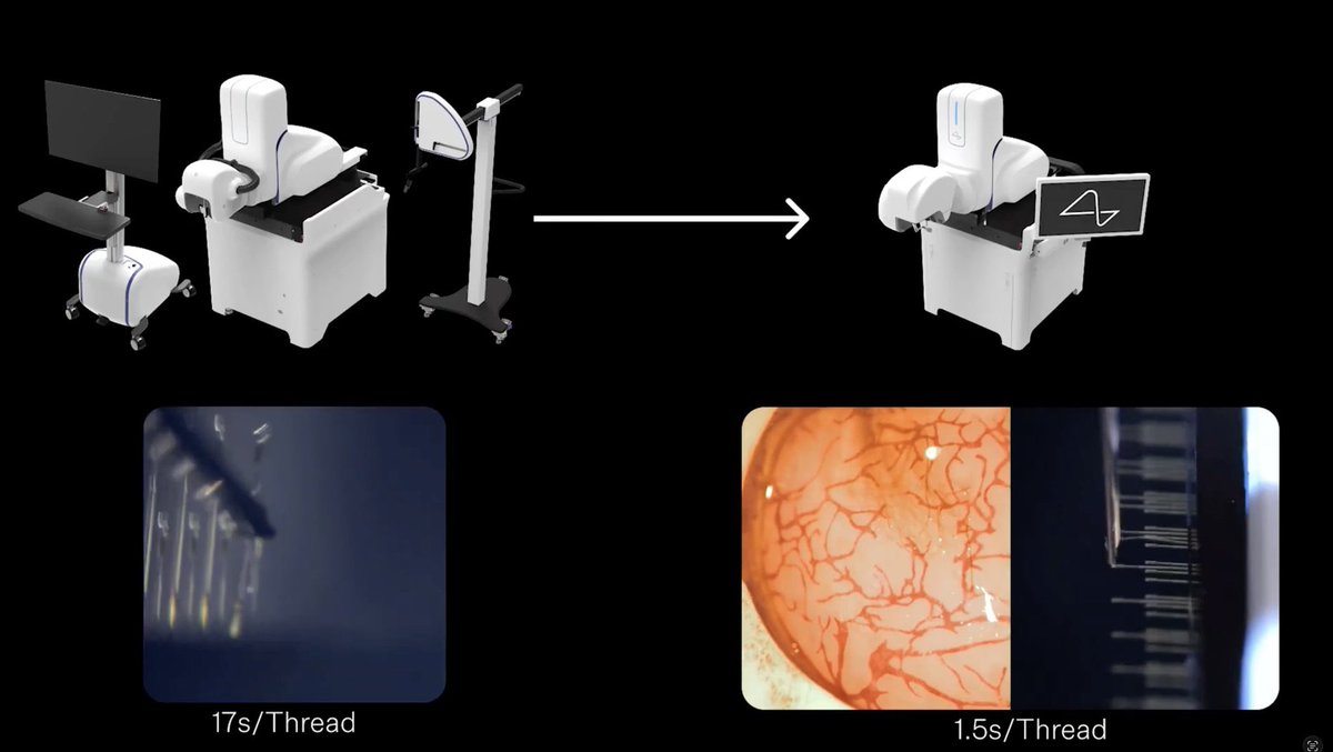 semivision_tw's tweet image. #Neuralink is preparing for the first human implant of its new brain chip, “Blindsight,” aimed at restoring vision in people who are completely blind—pending regulatory approval.

Elon Musk says vision would start low-resolution and improve over time through neural adaptation.