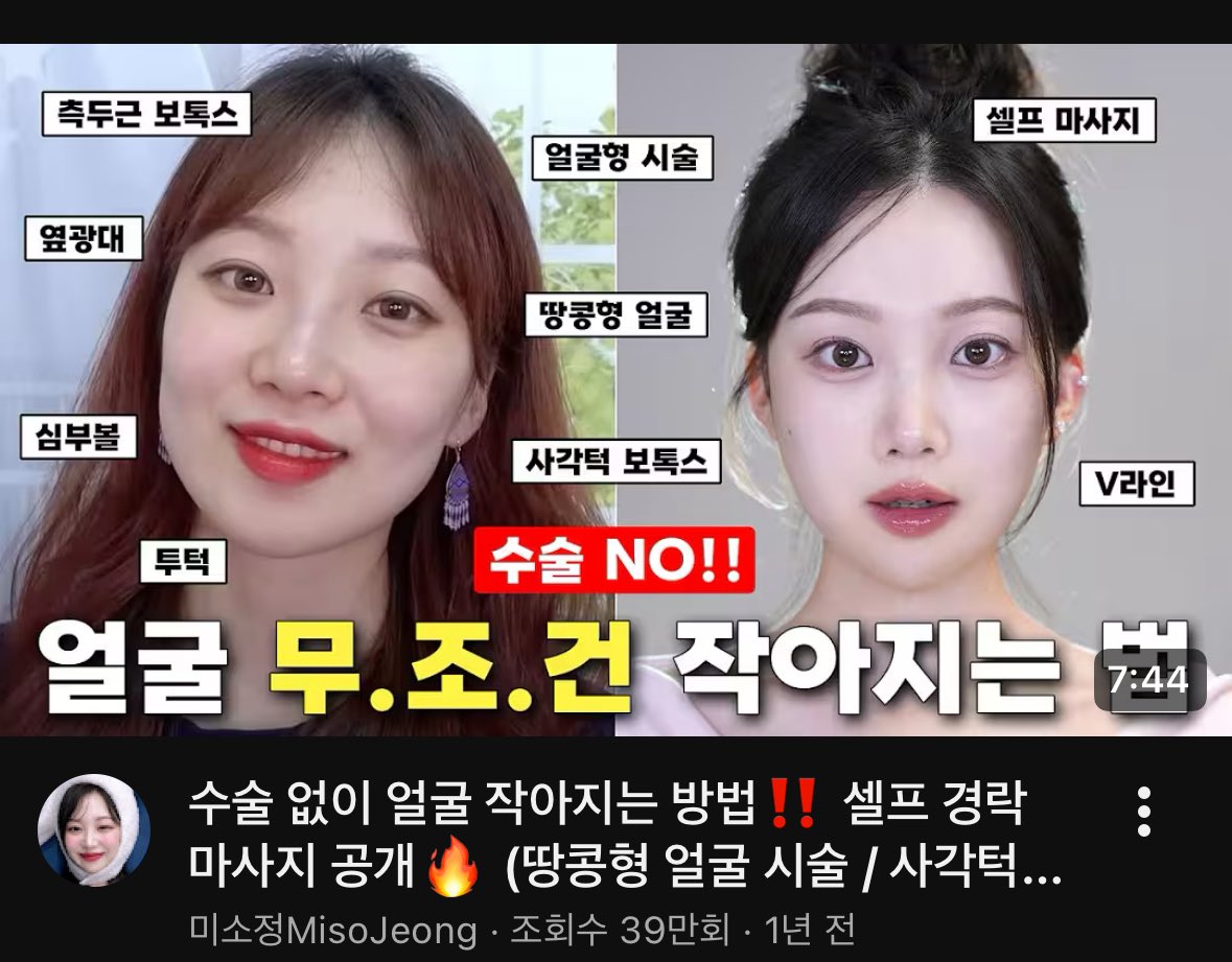 ‼️땅콩형 얼굴 주목 🥜

나 완전 광대 발달,사각턱인데 😭
이거랑 홈디바이스 같이 하니까 얼굴형 완전 예뻐짐 🩷
자기 전에 해주면 되고 크림 꼭‼️ 바르고 하기