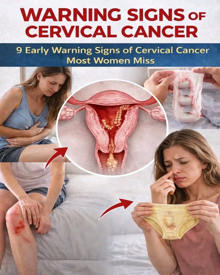 9 Early Warning Signs of Cervical Cancer Most Women Miss | Cervical Cancer Symptoms👇👇👇