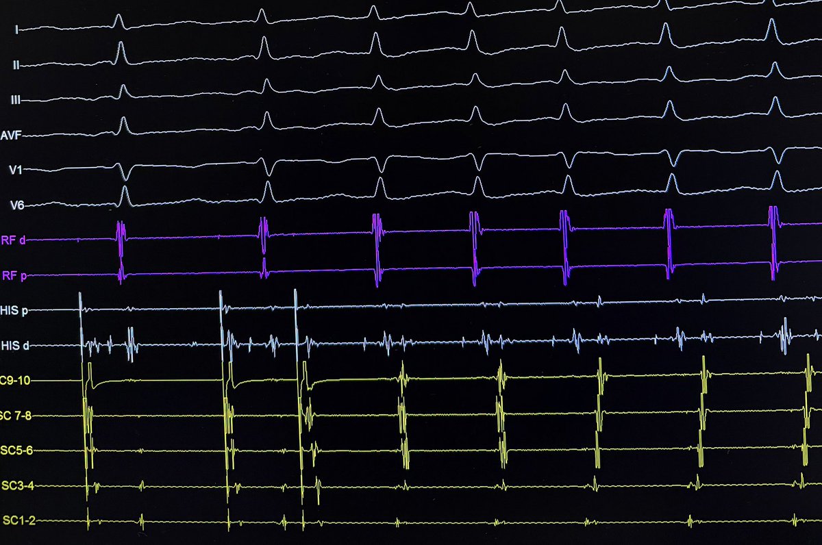 Rodrigo Isa Param tweet media