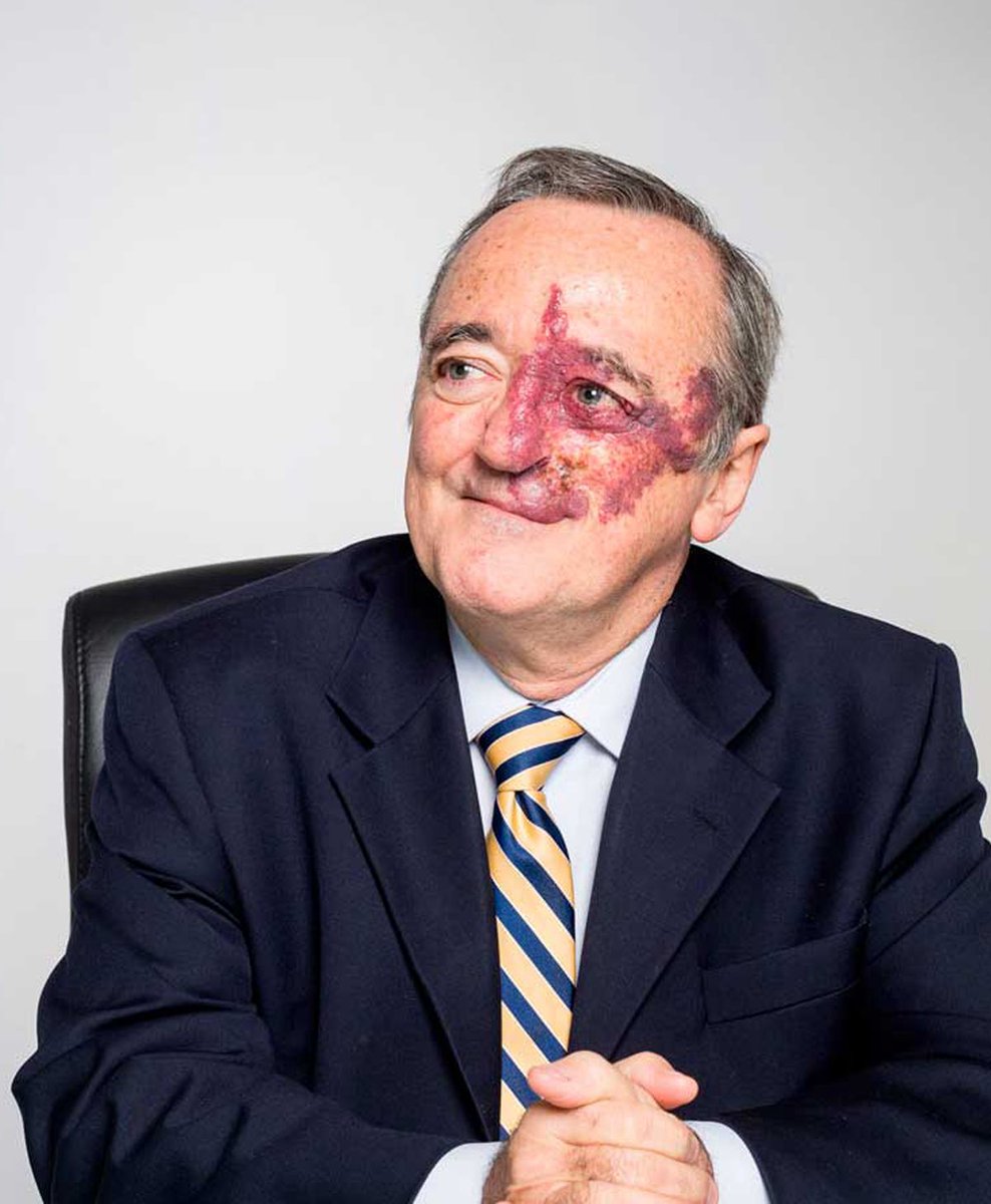 forallcurious's tweet image. BREAKING🚨: This is Mariano Barbacid, the scientist who may have discovered the cure for pancreatic cancer.