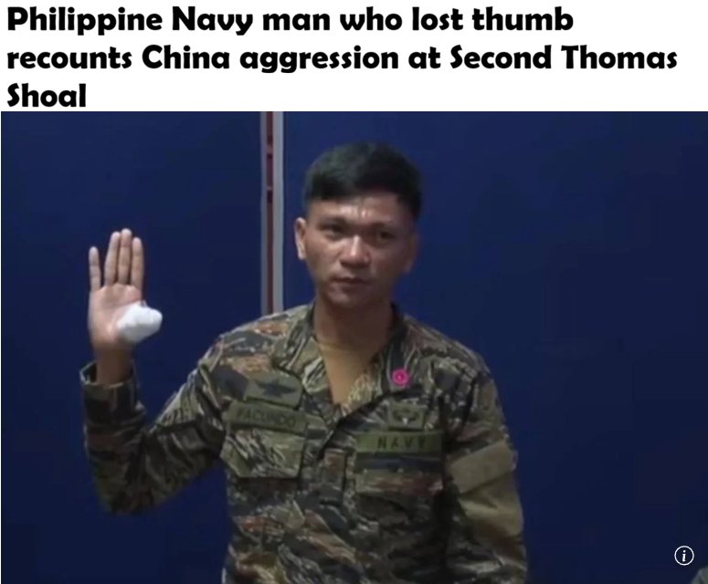 Did <a href="/Chinaembmanila/">ChineseEmbassyManila</a> apologise for this?

The goons of China Coast Guard severed the thumb of Filipino soldier inside Philippines' territory but did we hear anything from the Chinese propaganda mouthpieces??