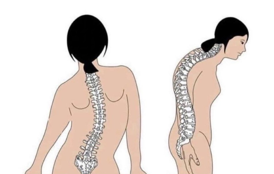 Lui: mi piacciono le tue curve.
Le mie curve: