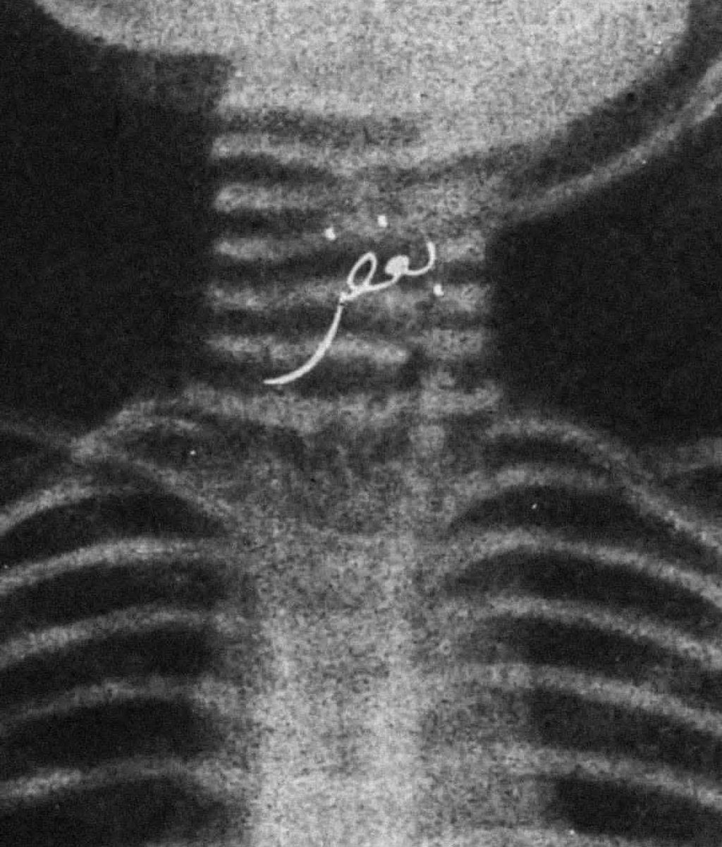 1Mohaamd's tweet image. حس میکنم با چیزایی که دیدم حتی اگه همه چیز هم درست شه من دیگه اون آدم سابق نشم ...