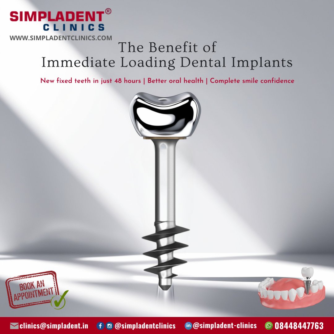 SimpladentC's tweet image. Achieve Your Dream Smile in Just 48 Hours with Simpladent® Clinics! ✨🦷

Book Your Appointment

📞 +91-8448447763
✉ clinics@simpladent.in
🌐 simpladentclinics.com
📍 g.page/r/CZdJVQ-8OsDd…

#SimpladentClinics #ImmediateLoadingImplants #NewSmile #DentalImplants #OralHealth