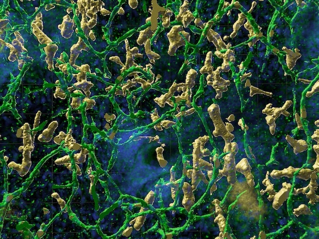 Biomedical Picture of the Day BPoD (@bpod_s) on Twitter photo Immune cells drive development of vessels in the skin
📹 still: Nusayhah Hudaa Gopee, Elena Winheim, <a href="/BayanneOlabi/">Bayanne Olabi</a> et al <a href="/Muzz_Haniffa/">Muzlifah Haniffa</a> <a href="/nubiosciences/">@NUBiosciences</a> <a href="/krkoehler/">Karl Koehler</a> <a href="/BostonChildrens/">Boston Children's</a> <a href="/teichlab/">Teichlab</a> <a href="/sangerinstitute/">Wellcome Sanger Institute</a> in <a href="/Nature/">nature</a>
➡️: bpod.org.uk/archive/2024/1… Immune cells drive development of vessels in the skin
📹 still: Nusayhah Hudaa Gopee, Elena Winheim, <a href="/BayanneOlabi/">Bayanne Olabi</a> et al <a href="/Muzz_Haniffa/">Muzlifah Haniffa</a> <a href="/nubiosciences/">@NUBiosciences</a> <a href="/krkoehler/">Karl Koehler</a> <a href="/BostonChildrens/">Boston Children's</a> <a href="/teichlab/">Teichlab</a> <a href="/sangerinstitute/">Wellcome Sanger Institute</a> in <a href="/Nature/">nature</a>
➡️: bpod.org.uk/archive/2024/1…