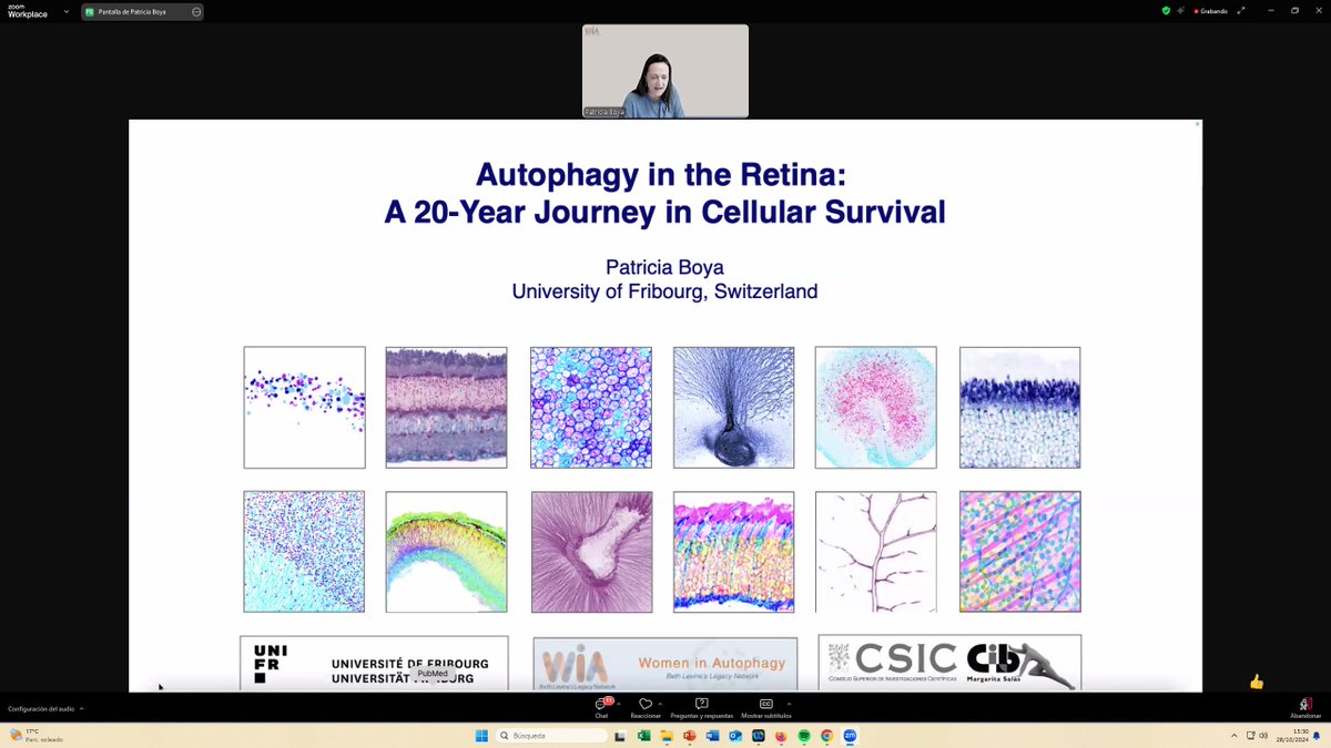 Women in Autophagy (@wautophagy) on Twitter photo Our wonderful Keynote Speaker <a href="/patricia_boya/">Patricia Boya</a> is explaining her wonderful science... don't miss it!! #BeautifulScience #Autophagy #Retina #WIA2024meeting Our wonderful Keynote Speaker <a href="/patricia_boya/">Patricia Boya</a> is explaining her wonderful science... don't miss it!! #BeautifulScience #Autophagy #Retina #WIA2024meeting