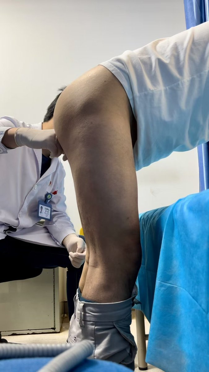 检查中
#男科体检