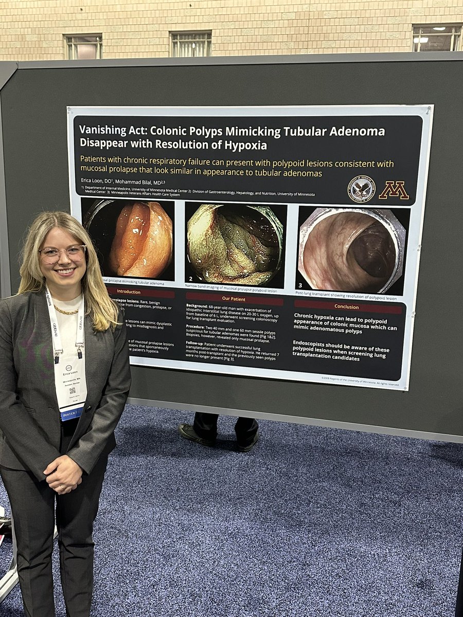 .<a href="/EricaLoonDO/">Erica Loon, DO</a> doing her thing !

Presenting  case of Vanishing Polyps seen with Hypoxia #ACG2024

<a href="/AmCollegeGastro/">ACG</a>