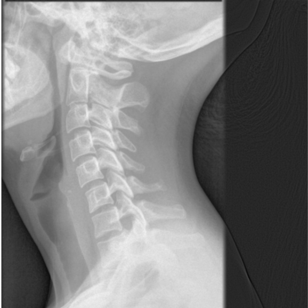 OpenCV_4's tweet image. 頸椎側面撮影

頸椎は、Cと略して呼ぶこともあります！
第１頸椎（環椎）は C１。