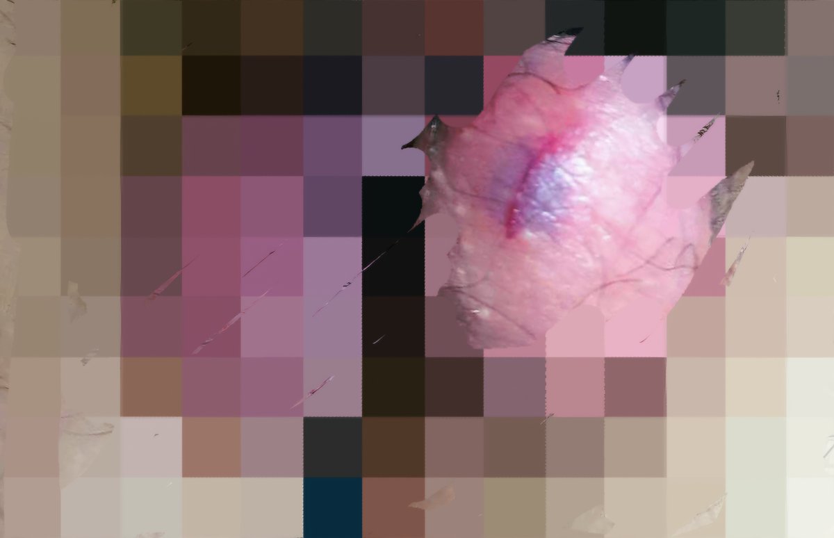 #섹트 #펨돔 #하드 #볼버 #볼버스팅 #파열 #거세

으깨지지 않아서 살릴 수 있지만 내용물을 쭉 짜낼수 있는 순간.

고환이 터졌다는 건 이럴 때 쓰는 말이지