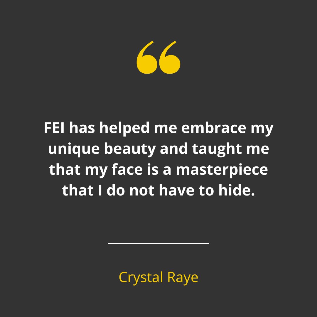 FaceEqualityInt's tweet photo. Excited to share this quote during #BritishBeautyWeek! A huge thank you to Crystal, who raised $275 for FEI through her Facebook birthday #Fundraiser 🎈
Is your birthday coming up? Why not make your birthday count and start your #FacebookFundraiser today? 🎁
#FaceEquality https://t.co/NQtZPhwA5p