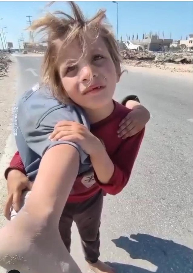 من مسافات على الأقدام سرتي
كيف أنتِ..
هل تعبتِ...؟؟
هل فترتي؟؟؟
هل أكلتي أو شربتي
من ركامٍ تحت هدمٍ قد خرجتي
وعليك بعض آثارٍ جُرحتي..
ثم انك رغم إعيائك سِرتي
تحملين الثقل هذا...
وقدرتي...؟؟
فاستشاطت غضباً نحوي وقالت
إن هذا ليس ثقلاً...🥺
إنما هذه أُختي 😞💔
*✍🏻/جميل شريف*