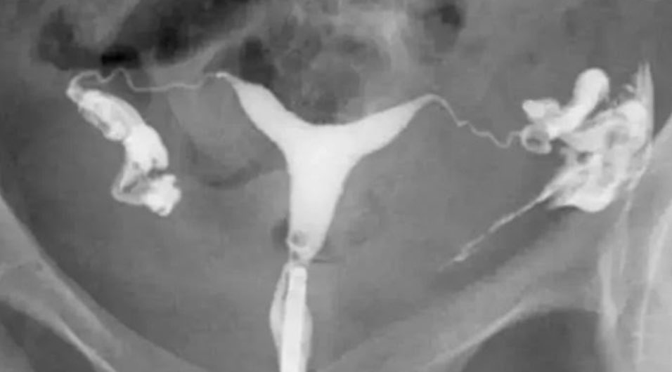 Naif Alsaikhan | د. نايف بن حمد الصيخان tweet media