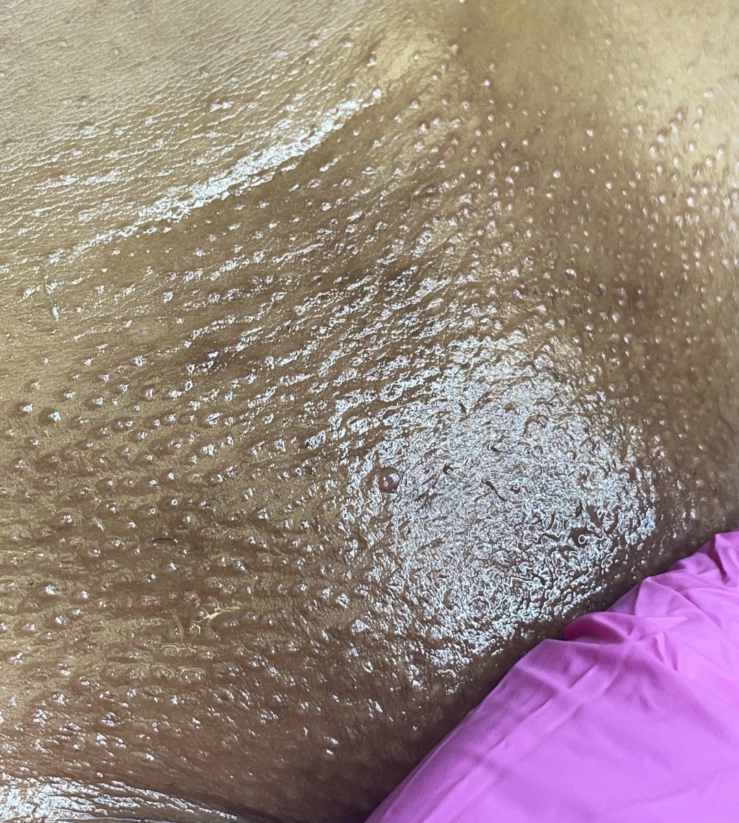 SymanthahK's tweet photo. I love what I do! Book your appointment ladies ❤️ 

Ig @skynvestment.htx

#houstonwaxer
#waxer #esthetician https://t.co/0bsqZBc4U9