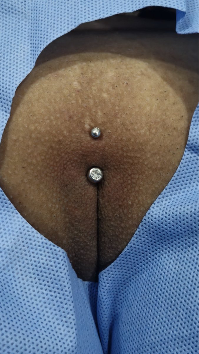 nick_piercing's tweet photo. Piercings íntimos https://t.co/IskFLAlB8D
