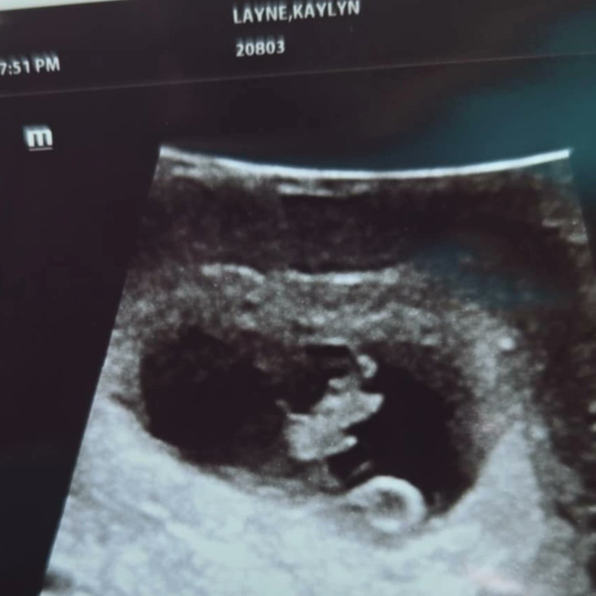 Kaylyn Layne tweet media