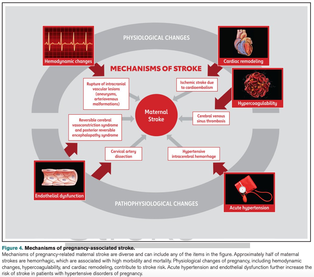 SeguraCardio's tweet photo. ⚠️2024 #Guideline for the Primary Prevention of Stroke: A Guideline From the @American_Heart📚
#PositionPaper #Stroke #Prevention #CardioPrev #AHA https://t.co/1f6VzAzDGF