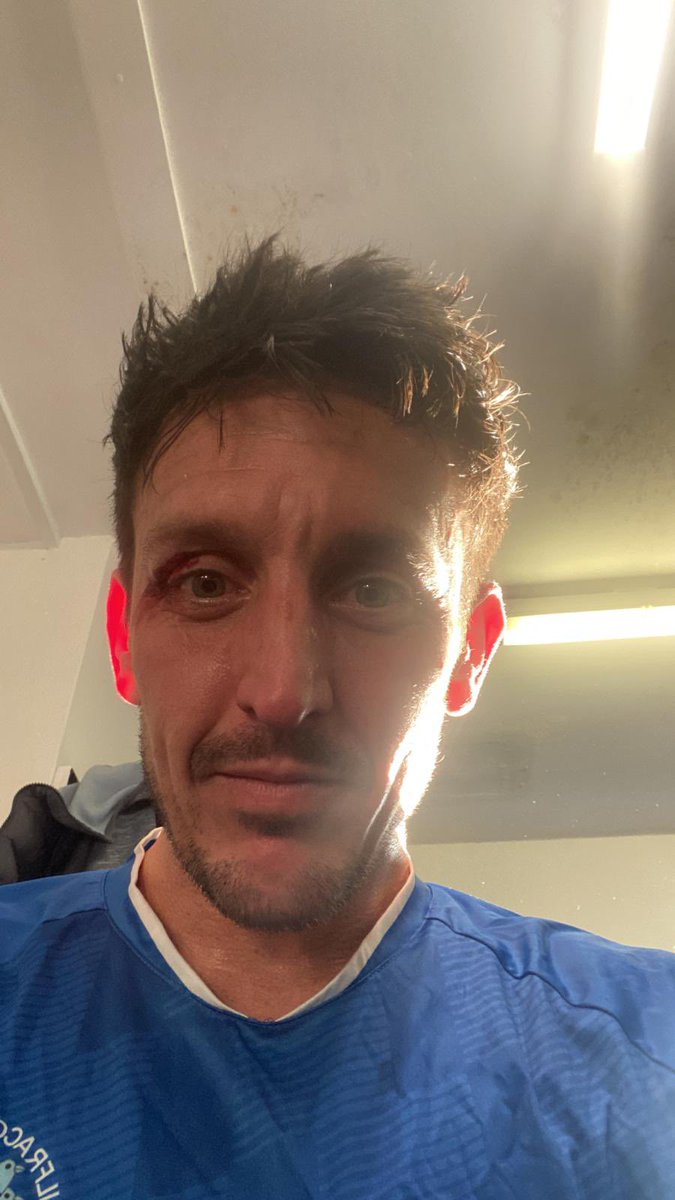 𝐈𝐥𝐟𝐫𝐚𝐜𝐨𝐦𝐛𝐞 𝐓𝐨𝐰𝐧 𝐀𝐅𝐂 tweet media