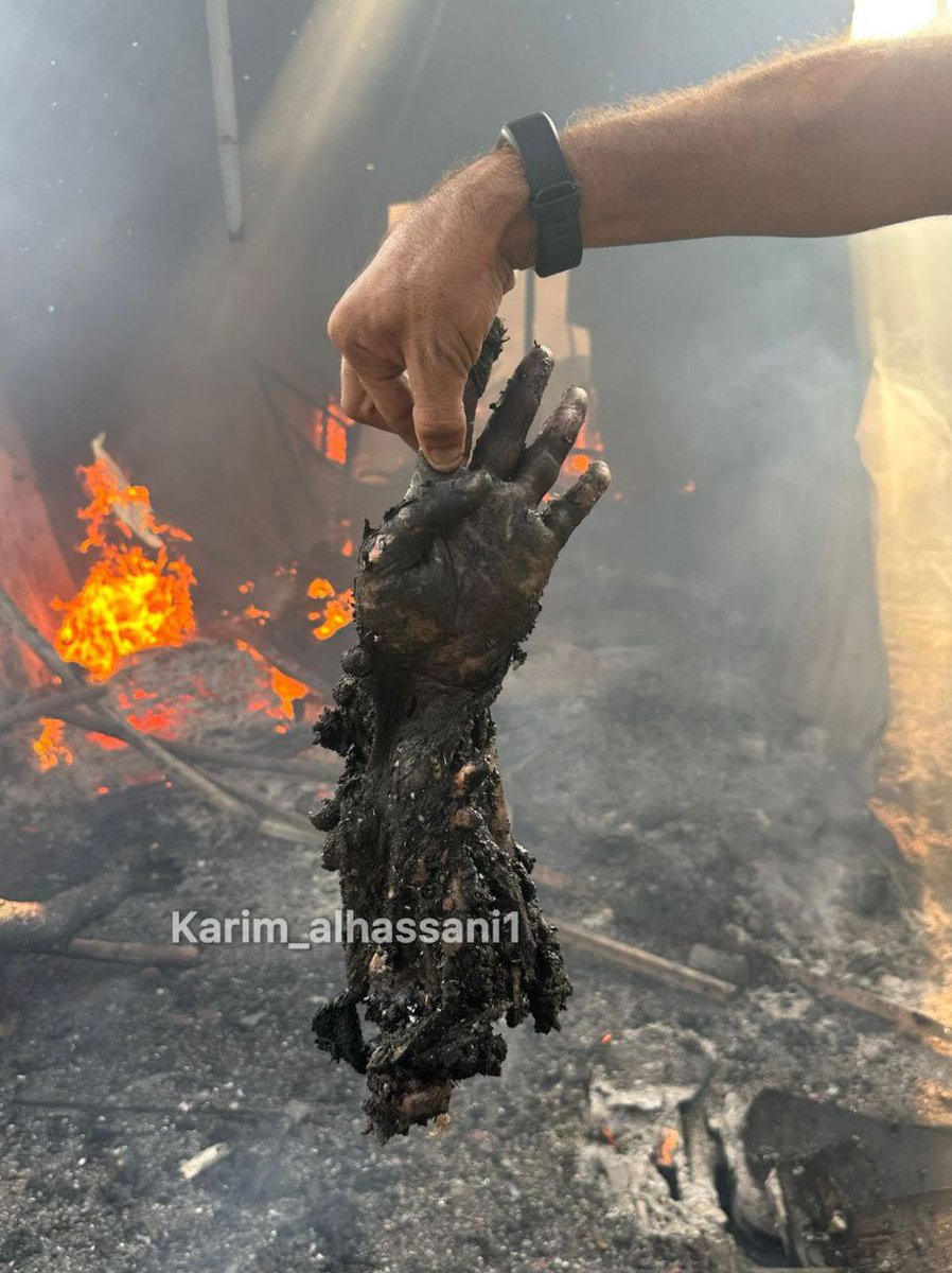 385 gün!
Hâlâ öldürülüyorlar.
Alışmak ihanettir.
Alışmakdan Allah'a sığınırım..!