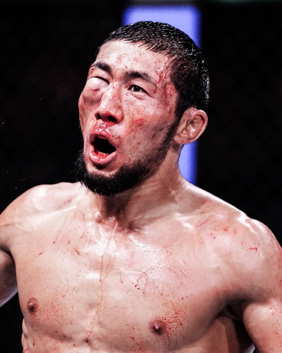 batsunbayy's tweet photo. @espnmma OROLBAI’S EYE IS GONE badly injured well played both #UFC308 https://t.co/ruuveUXuLe