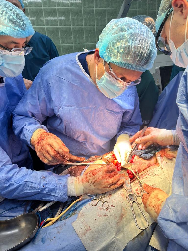 Reconstructive urology workshop in Kyiv, Ukraine
5 days. 22 complex recon cases.. <a href="/UroRecon/">Dmitriy Nikolavsky</a> <a href="/podalola/">Dr. P. Damián López Alvarado</a> <a href="/RamonVirasoro/">Ramón Virasoro, MD</a> <a href="/GBratslavsky/">Gennady Bratslavsky</a> <a href="/WagnerA39449159/">Wagner França</a>
thank you for your contribution to the treatment of Ukrainian wounded warriors! We appreciate your support!
#reconstructiveurology