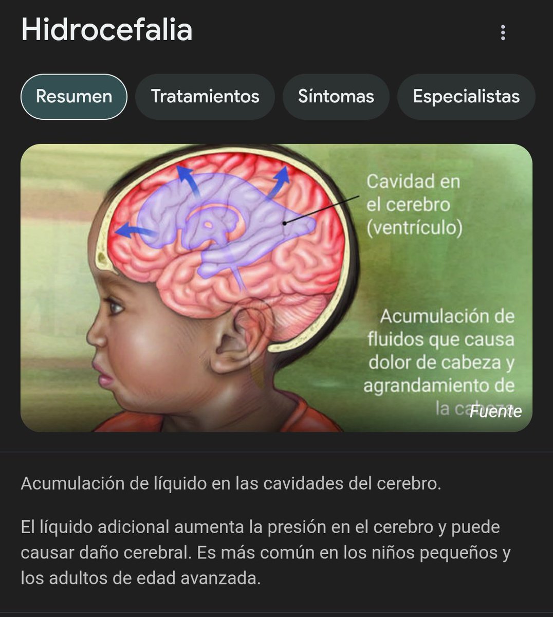 crz_dech's tweet photo. @elManiki09 @ElRichConCrocs Joer perdón no conocía tu condición, no volveré a burlarme https://t.co/C3uSE2Iq0T