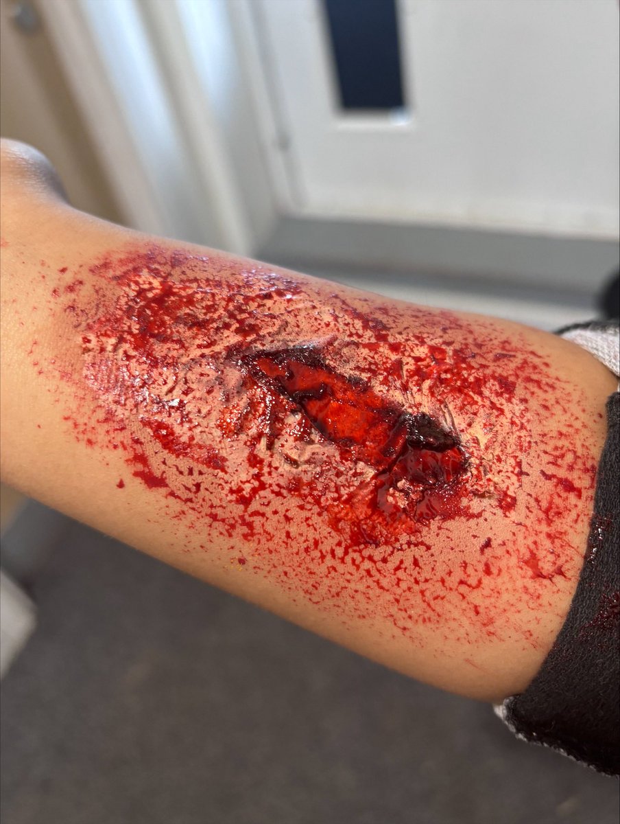 EdgeNorthfield's tweet photo. Students from our Hair and Beauty option were experimenting with scarily-realistic make up effects for Halloween. Even our first aiders were fooled 🤣 If you are squeamish…look away now #changebeginshere #edgelife #expressyourindividuality https://t.co/2kF1t51pVU