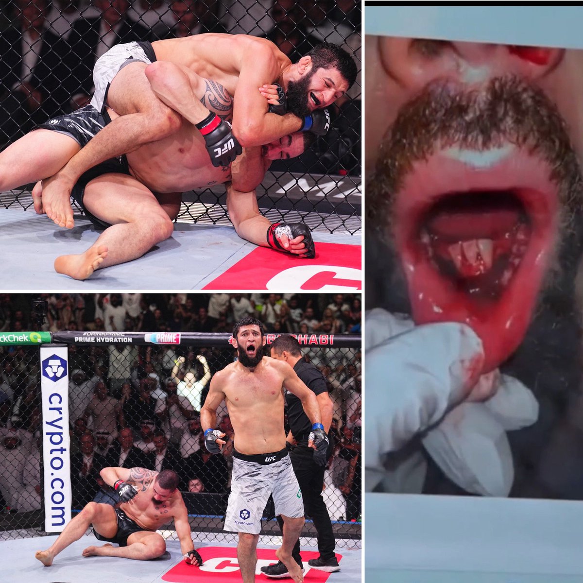 gastonreyno's tweet photo. Así le dejó la mandíbula Khamzat Chimaev a Whittaker en #UFC308 😳 https://t.co/06jezpEPwL