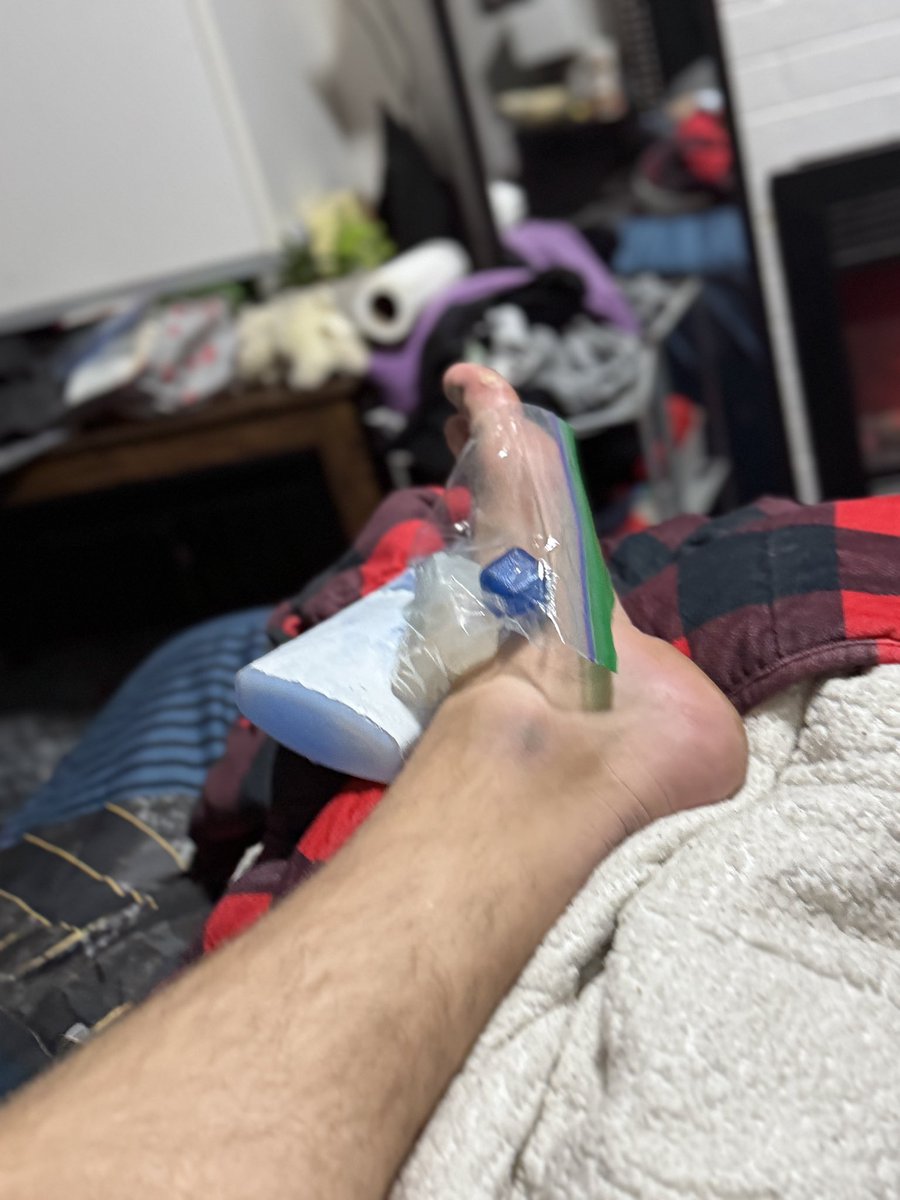 Pushed down a flight of stairs today…. That’s a great Saturday