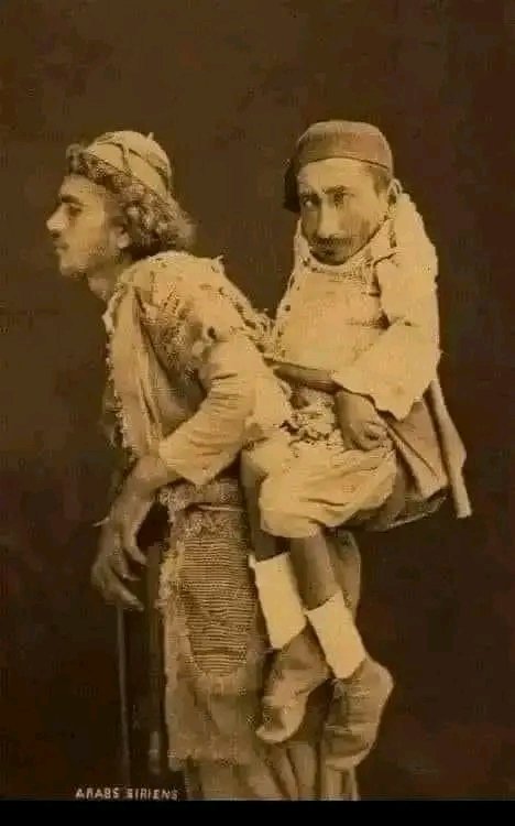 <a href="/historyinmemes/">Historic Vids</a> This photo was taken in Damascus in 1899. The dwarf is Samir. He is a Christian and cannot walk. The one who carries him on his back is Muhammad. He is a Muslim and he is blind.
Mohamed relies on Samir to tell him where to go, and Samir uses his friend's back to navigate the city