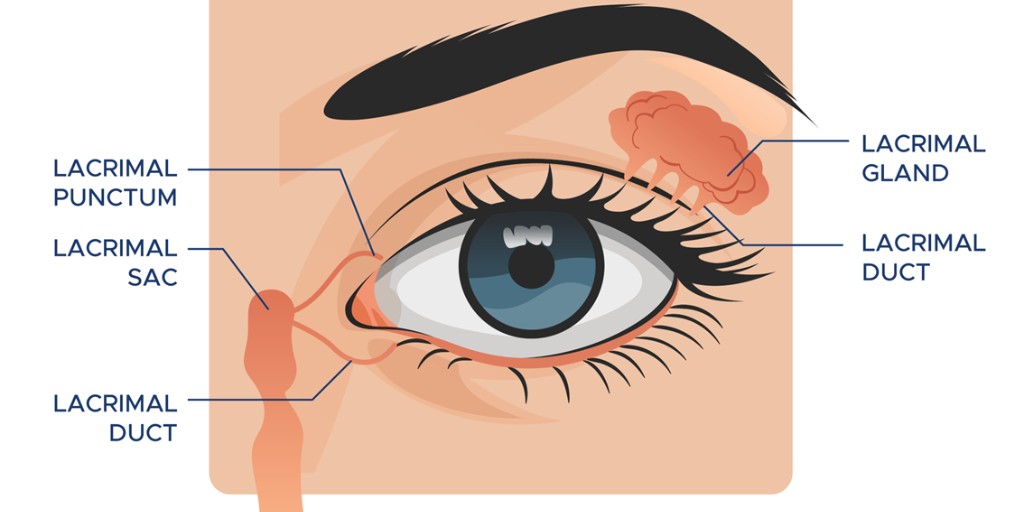 CollegeOptomUK's tweet image. Is lacrimal syringing your go-to for managing #epiphora?

While it can offer quick relief, it’s not always the first line of defence. Discover how this technique fits into a broader treatment plan by reading our latest #AcuityJournal article ➡️ coptom.uk/4dNwgPZ