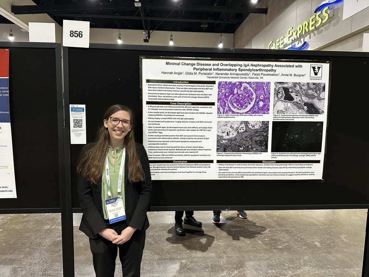 Gilda Portalatin (@gildaportalatin) on Twitter photo So proud of <a href="/hlangle02/">Hannah Angle</a> for presenting our amazing poster at ASN Kidney Week with the support of <a href="/anna_burgner/">Anna Burgner MD MEHP</a>🙌🏼
#asnkidneyweek #womeninmedicine
@VUMCKidney #Vanderbilt#kidneys So proud of <a href="/hlangle02/">Hannah Angle</a> for presenting our amazing poster at ASN Kidney Week with the support of <a href="/anna_burgner/">Anna Burgner MD MEHP</a>🙌🏼
#asnkidneyweek #womeninmedicine
@VUMCKidney #Vanderbilt#kidneys