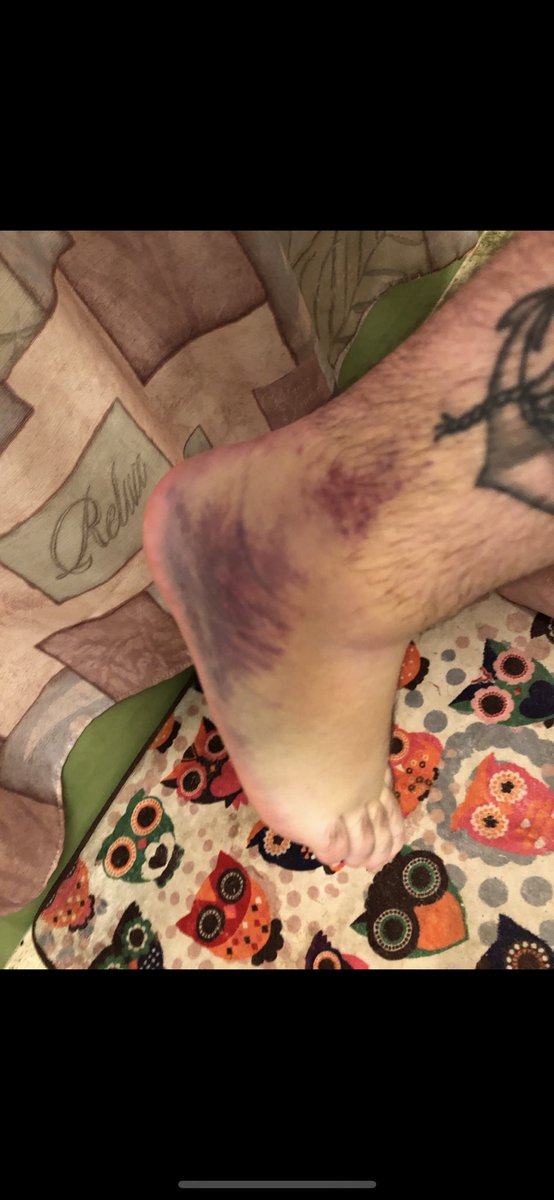 TheNextBigTimer's tweet image. Been there, 0/10 do not recommend