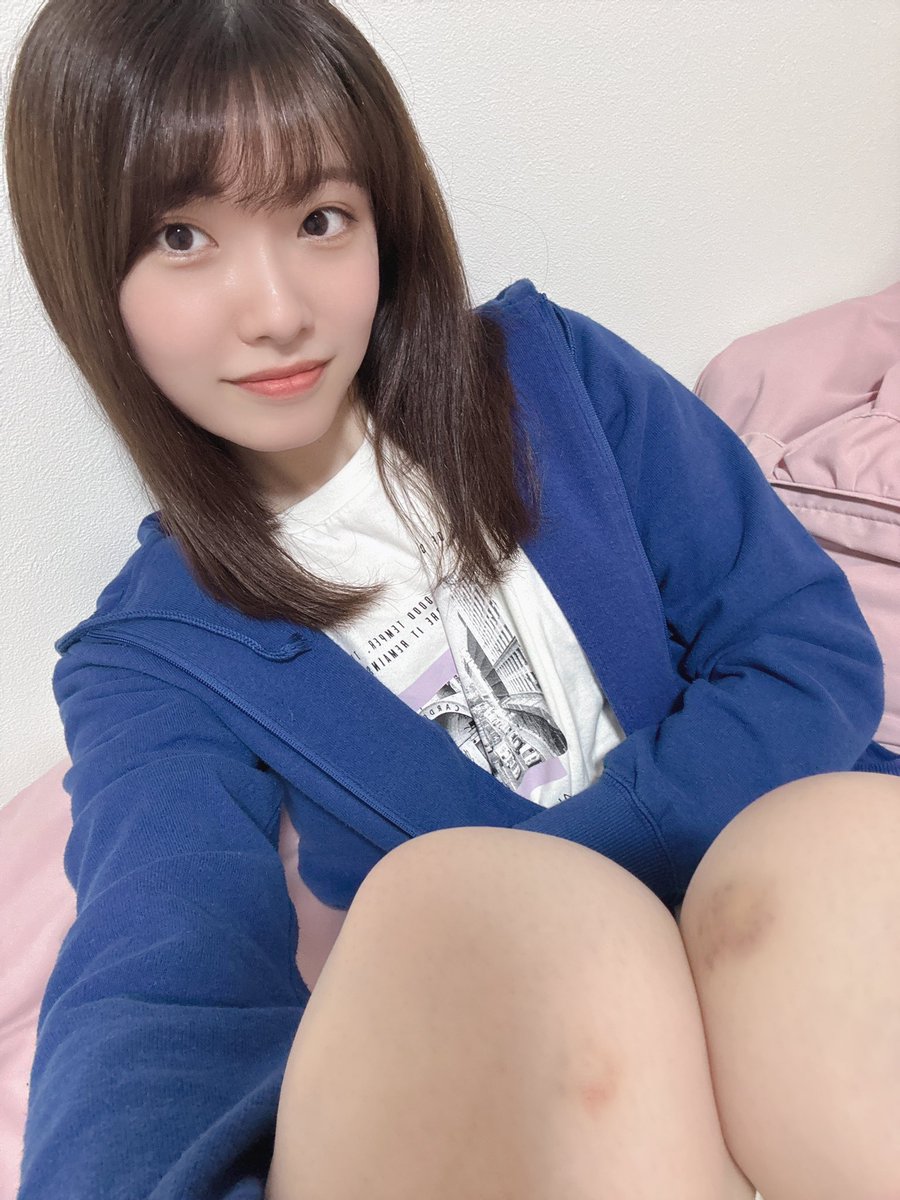 ひざにあざ🥲
