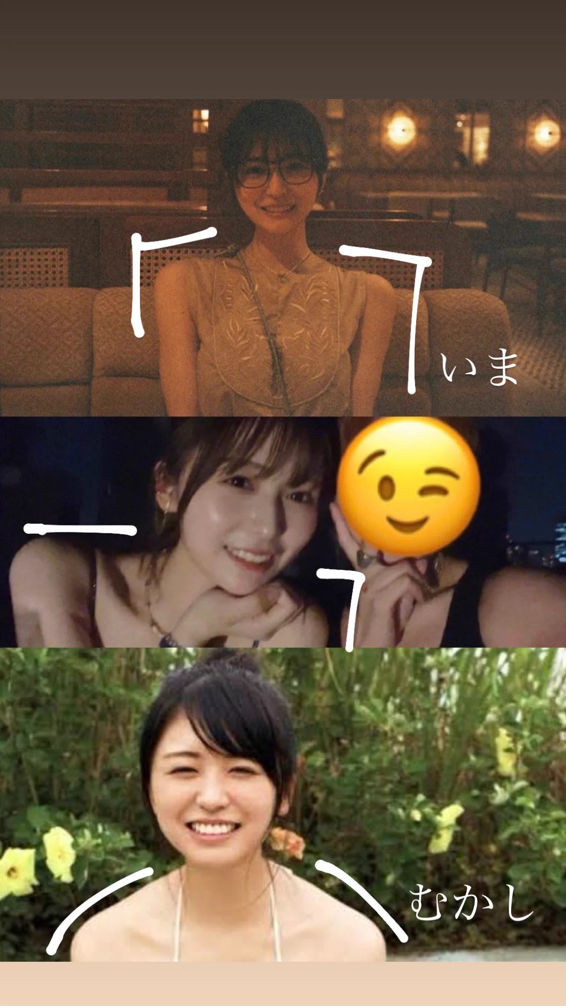 長濱 ねる 整形