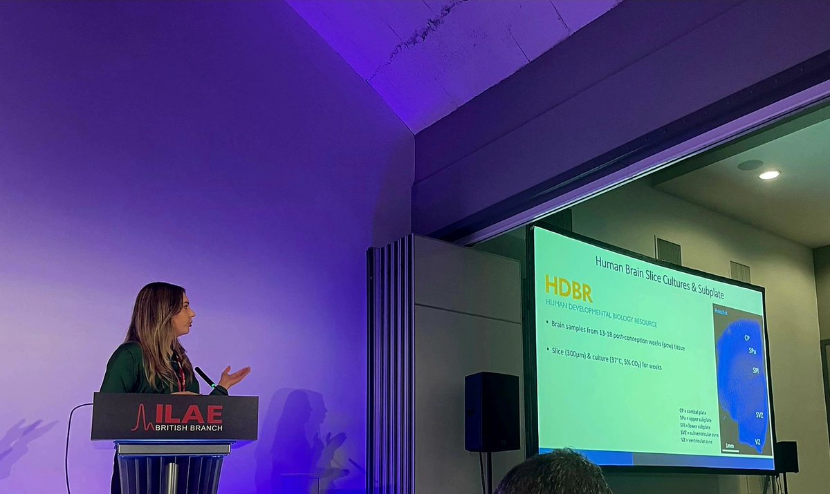 Anna Dimtsi (@anna_dts_) on Twitter photo It was great presenting part of my PhD work on #PRRT2 earlier this week!
Thank you to the <a href="/ILAEBRITISH/">ILAE BRITISH BRANCH</a> for giving me the chance!
#ILAE2024
<a href="/fayemcloud9/">Faye McLeod</a>
<a href="/EpilepsyInst/">Epilepsy Research Institute</a>
<a href="/ResearchNetERI/">ResearchNet ERI</a> It was great presenting part of my PhD work on #PRRT2 earlier this week!
Thank you to the <a href="/ILAEBRITISH/">ILAE BRITISH BRANCH</a> for giving me the chance!
#ILAE2024
<a href="/fayemcloud9/">Faye McLeod</a>
<a href="/EpilepsyInst/">Epilepsy Research Institute</a>
<a href="/ResearchNetERI/">ResearchNet ERI</a>