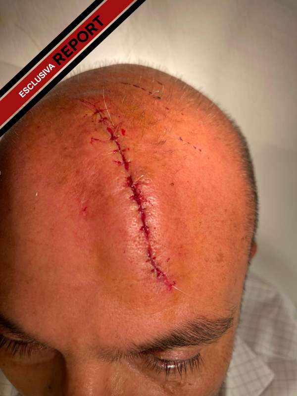 DeerEwan's tweet image. I cosiddetti &quot;Tagli alla Cultura&quot;. 

#Sangiuliano #Boccia #reportrai3