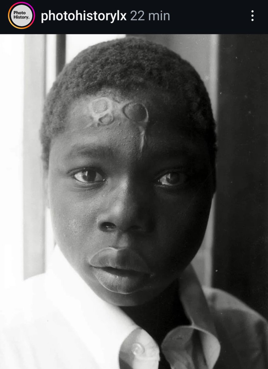"Os portugueses foram colonizadores diferentes"...
Moçambique 1973 - "jovem pastor marcado na testa com um ferro de marcar gado. [...] o jovem tinha perdido uma rês"
Via <a href="/PhotoHistorylx/">PhotoHistory.</a>