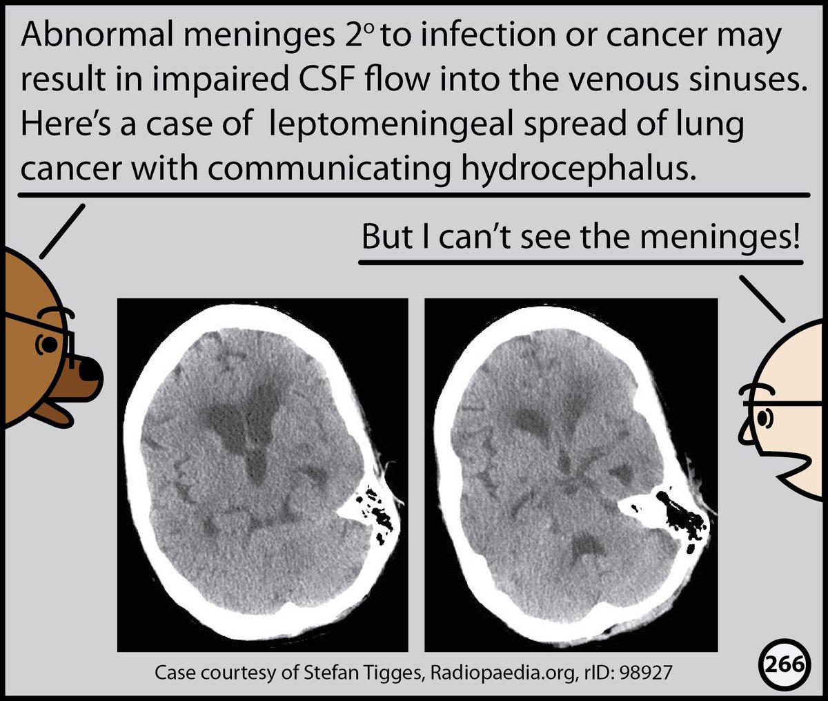 StefanTigges's tweet photo. This month, I’ll post excerpts from our Head CT comic. The complete comic is available for free here: https://t.co/wPeVKtheqM https://t.co/aCYHhMlSRd