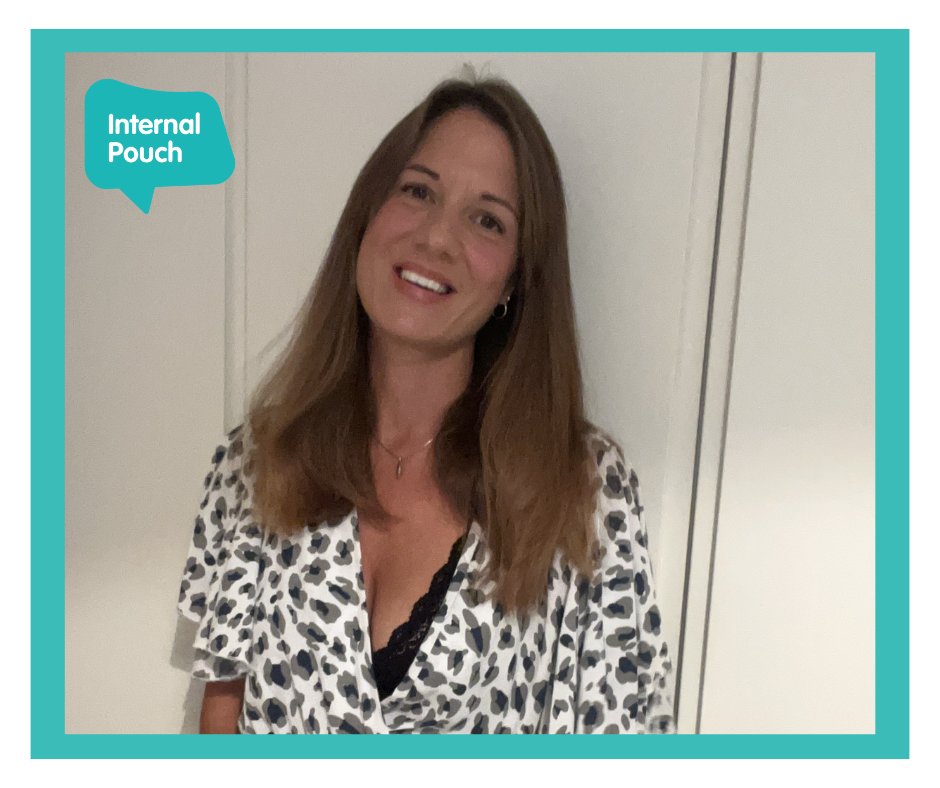Tertia opted for a J Pouch in 2008. Tertia told us, "There has been so much body positivity surrounding ileostomies recently....so with the knowledge I now have, I don’t think I would opt for J-pouch surgery.” 

#ToPouchOrNotToPouch #IPAM #InternalPouchAwarenessMonth