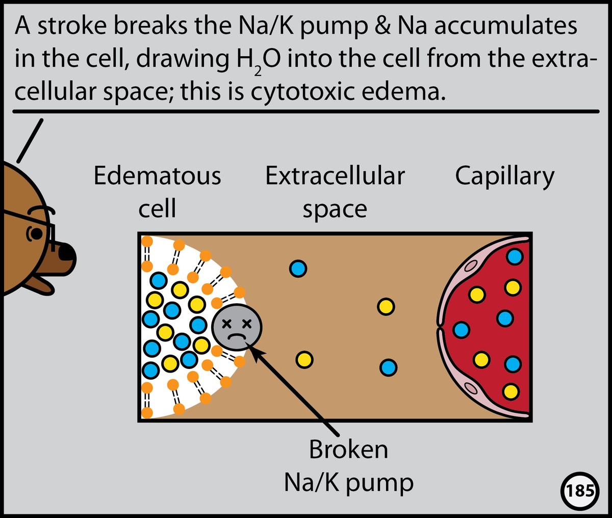 StefanTigges's tweet image. This month, I’ll post excerpts from our Head CT comic. The complete comic is available for free here: radiopaedia.org/courses/head-c…